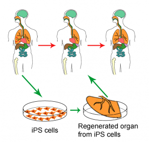 Regenerated organ from iPS cells