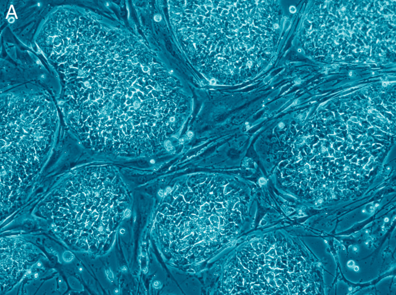 (Human embryonic stem cell/Nissim Benvenisty)