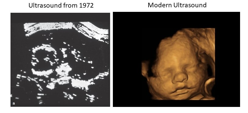 Justice Breyer is Wrong: Modern Advances in Ultrasound and Fetal Surgery Anything But “Slim”