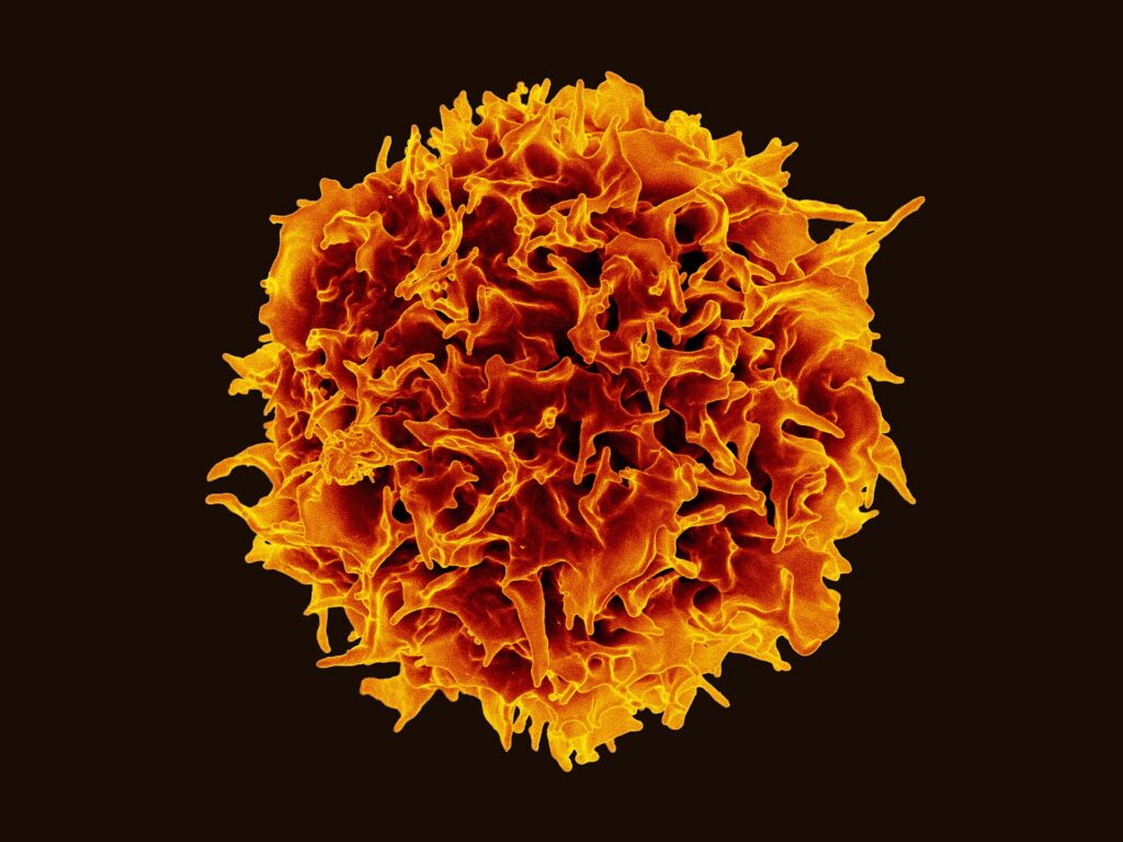 A highly magnified, colorized image of a human T cell—central to immunity—shows an irregular, spiky, and textured orange surface set against a stark black background.