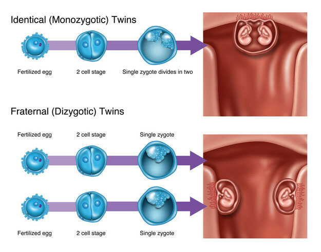 Fraternal Twins Fetal Development Fraternal Twins Fetal Development