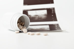 A white pill bottle lies on its side, spilling round beige tablets onto a white surface. Behind it, several blurred ultrasound images hint at the risks and complications associated with drug-induced abortion in this clinical, medical scene.