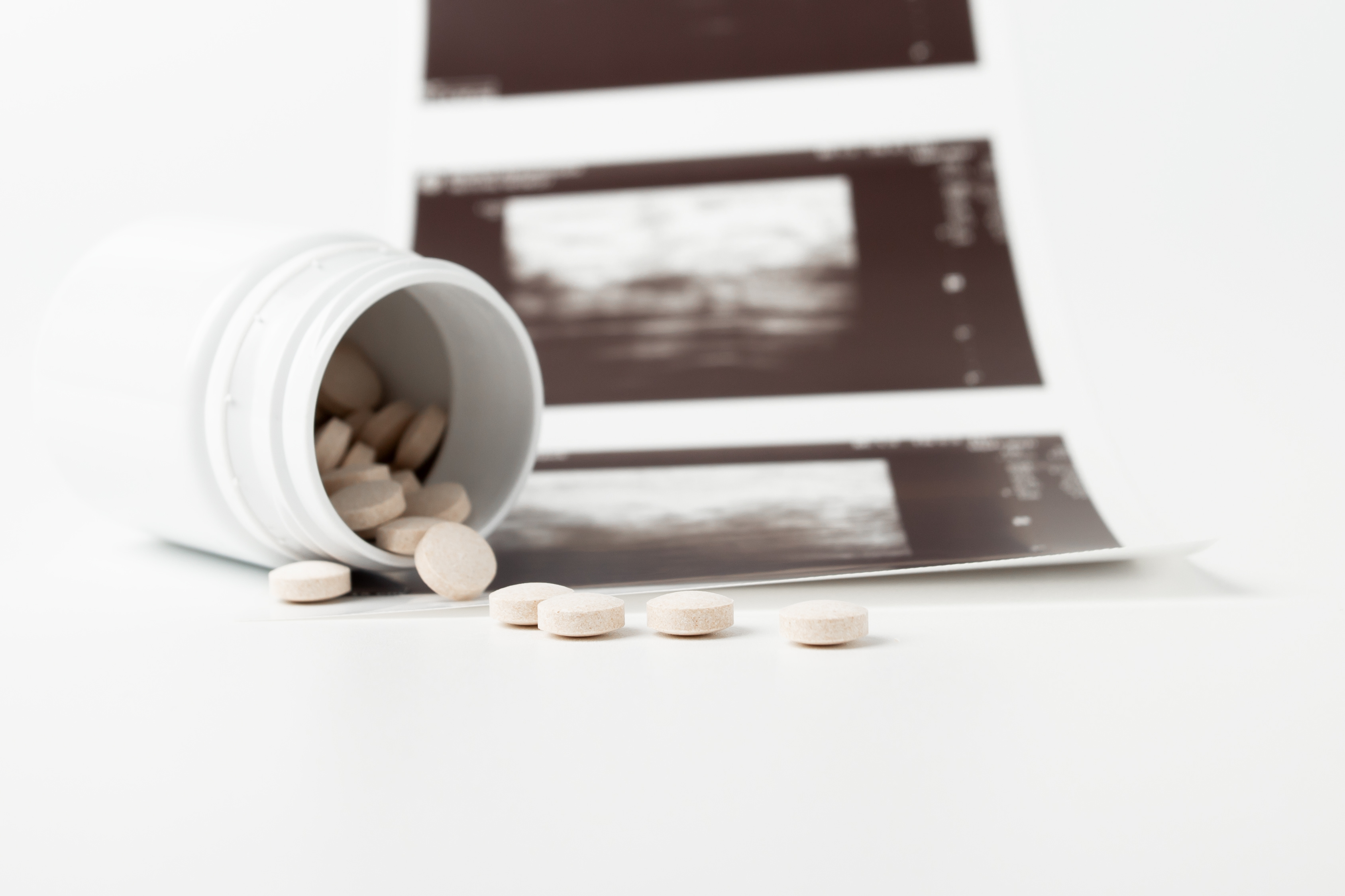 A white pill bottle lies on its side, spilling round beige tablets onto a white surface. Behind it, several blurred ultrasound images hint at the risks and complications associated with drug-induced abortion in this clinical, medical scene.
