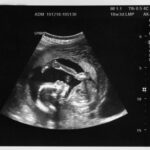 Fact Sheet: A Timeline of the Development of Fetal Pain Sensation