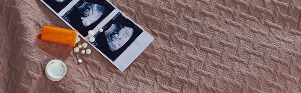 An orange pill bottle, scattered white pills, and an ultrasound photo strip rest on a textured pink fabric surface, symbolizing the experience of a medical abortion.
