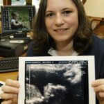 Science Is Making the Humanity of Unborn Babies Harder to Ignore