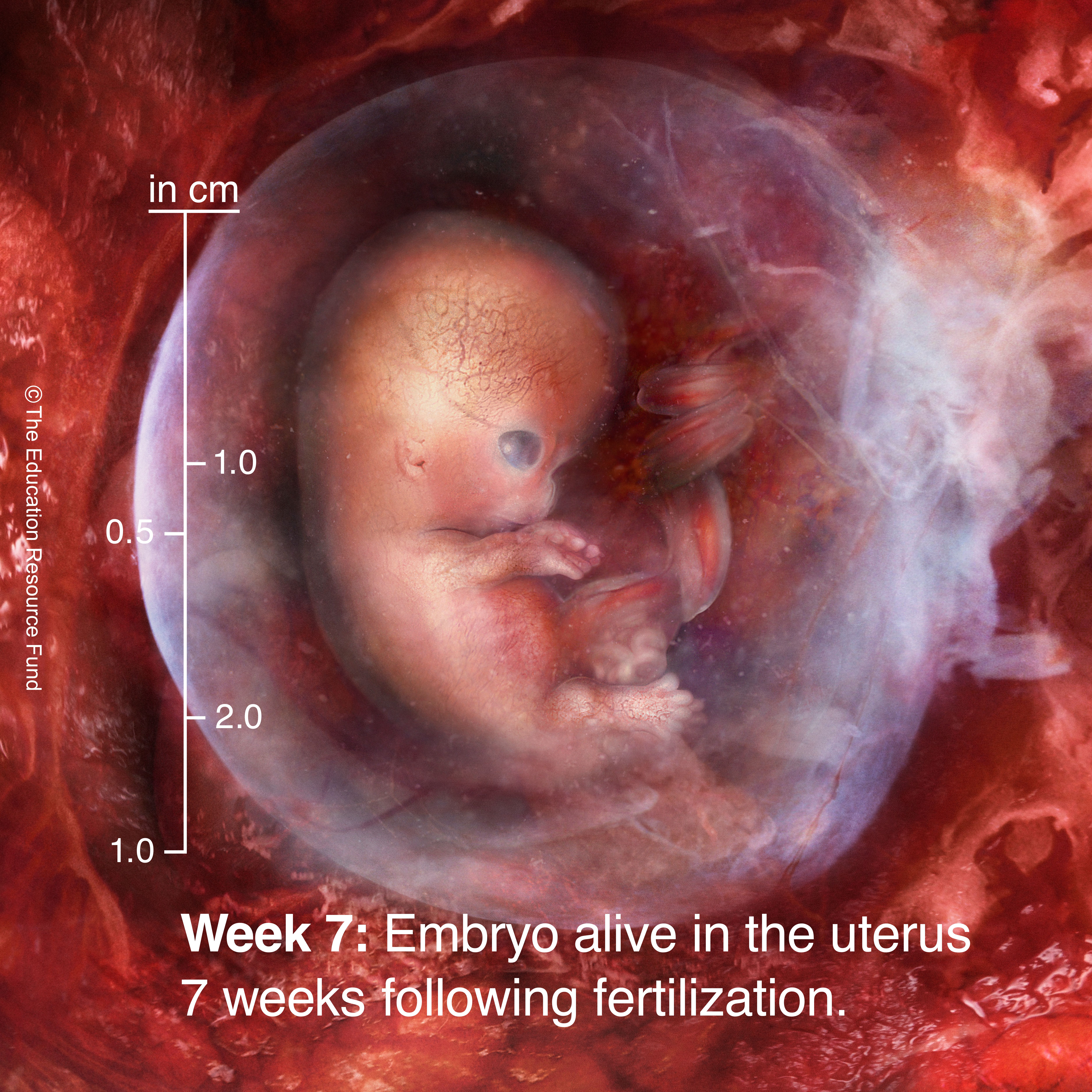 A seven-week-old human embryo inside the uterus, shown with a centimeter measurement scale for use in fetal development education.