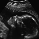 Inside The Government Decision That Opened Up Abortion Pill Floodgates